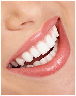 El Blanqueamiento dental