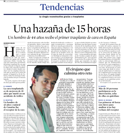 ENGUIX, Salvador, LÓPEZ, Celeste. Luz verde a que España haga sus dos primeros transplantes de cara. La Vanguardia. [en línea] 26 JUNIO 2009. [Consulta 07-01-2013]. Disponible en: http://hemeroteca.lavanguardia.com/preview/2010/11/17/pagina-30/78336045/pdf.html?search=Pedro Cavadas   […]