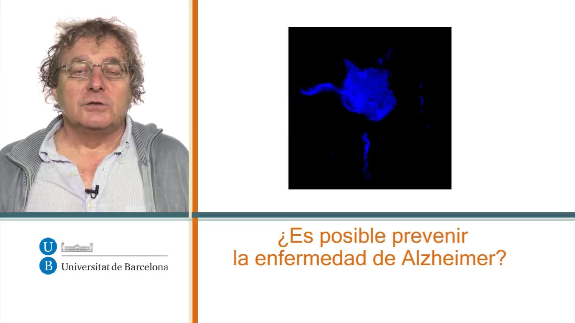 ¿Es posible prevenir la enfermedad de Alzheimer?